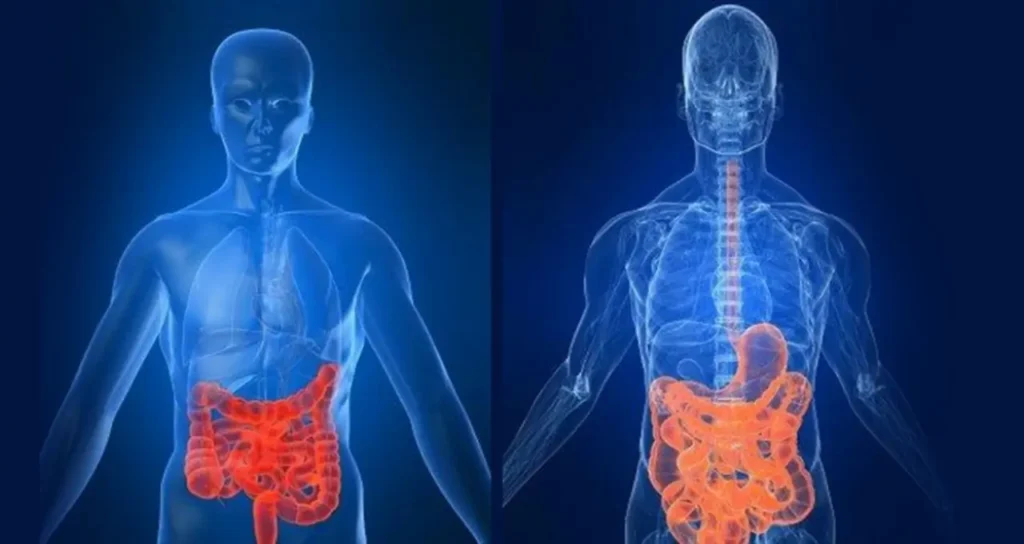 Infliximabe para Doença de Crohn Descubra Como Este Tratamento Revolucionário Pode Mudar Sua Vida
