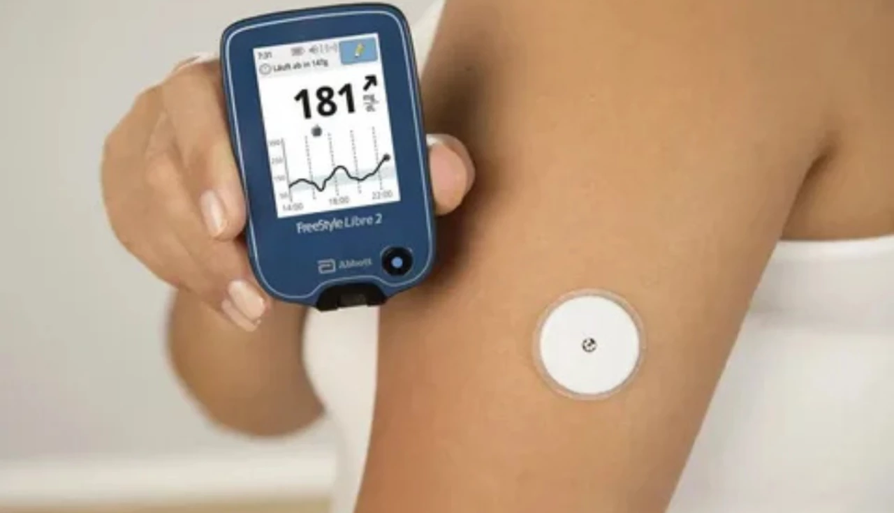 Obter Sensor Libre pelo SUS: Guia Completo para Pacientes Diabéticos 1 obter sensor libre pelo sus