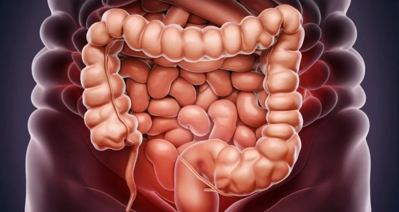 Infliximabe para Doença de Crohn: Descubra Como Este Tratamento Revolucionário Pode Mudar Sua Vida 1 Infliximabe para Doença de Crohn Descubra Como Este Tratamento Revolucionário Pode Mudar Sua Vida