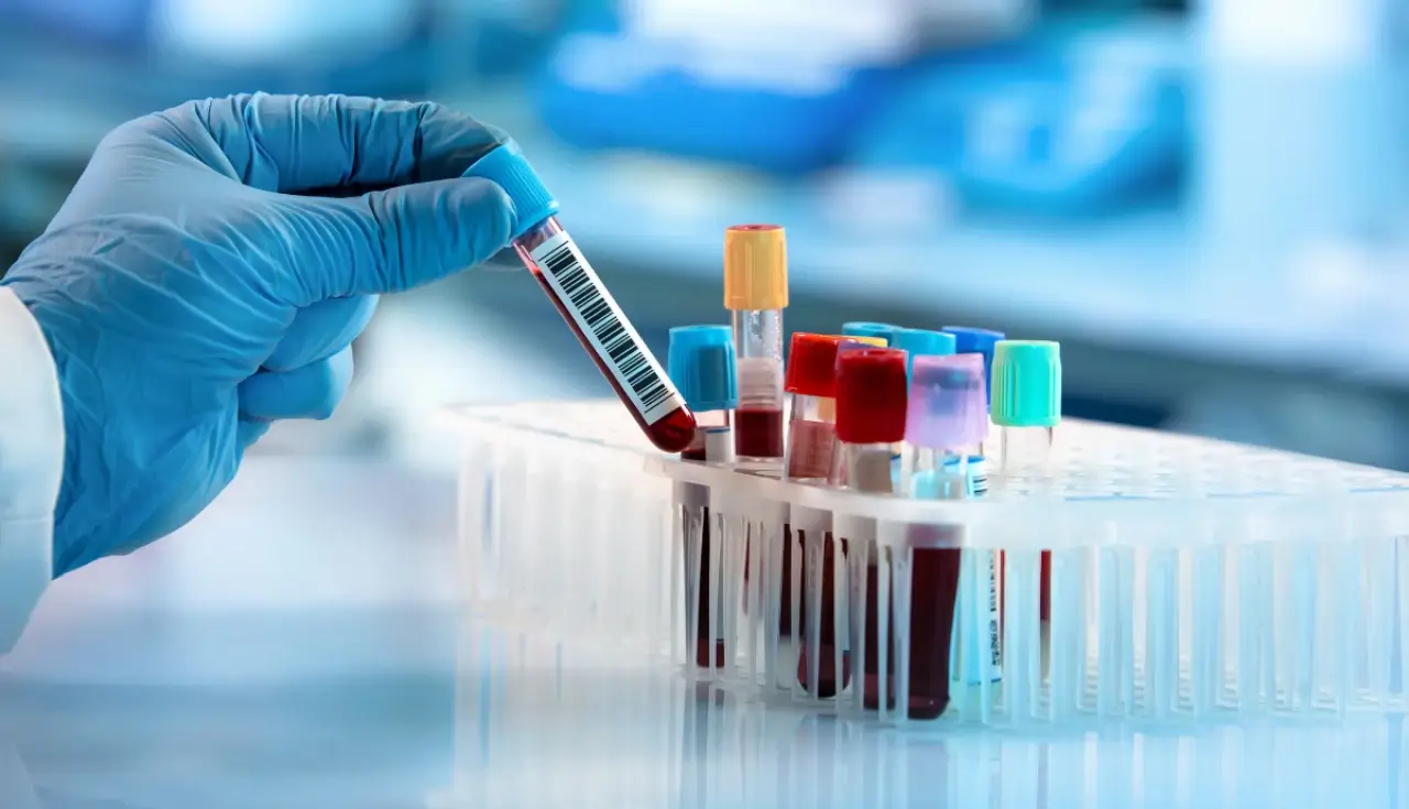 Leucemia: Sintomas, Tratamentos e Avanços na Pesquisa 2025 2 leucemia