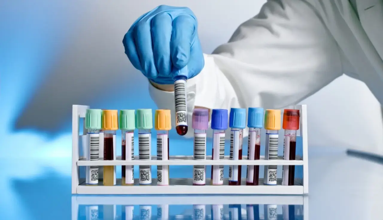 Leucemia Linfoblástica Aguda: Tudo o que precisa saber 2025 2 leucemia linfoblastica aguda 1 1 2